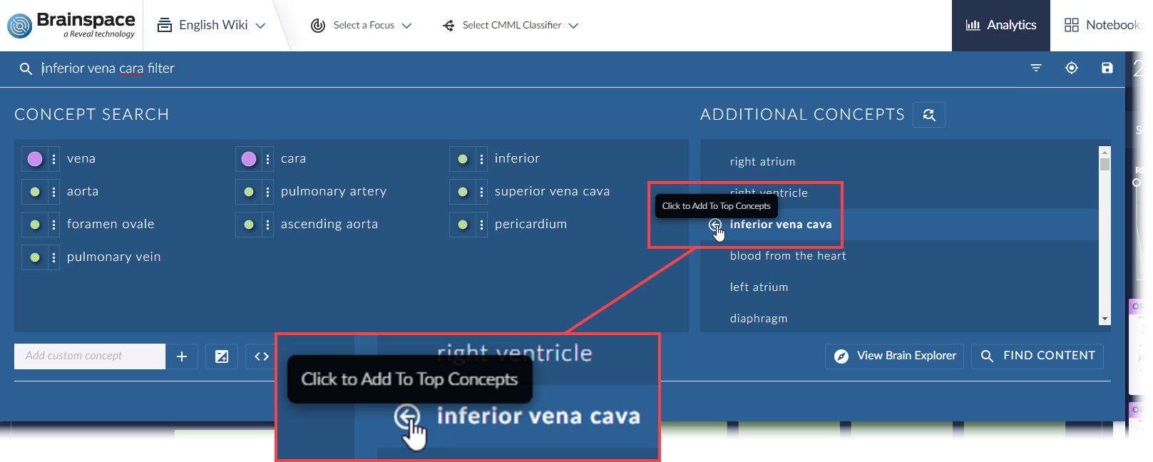 add interior vena cara 2